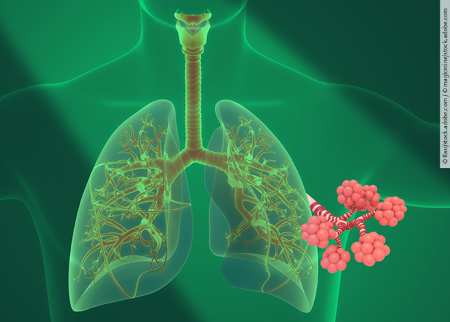 Spotlight_Lungenfibrose_Boehringer_312x175 4zevar/stock.adobe.com